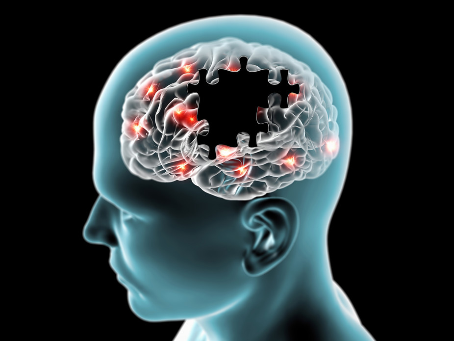 Nuramin for treatment of Parkinson