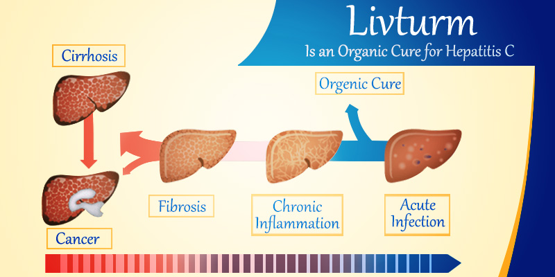 How To Treat Hepatitis B Naturally How To Treat Hepatitis B Naturally