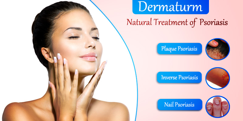 Dermaturm to cure Psoriasis naturally