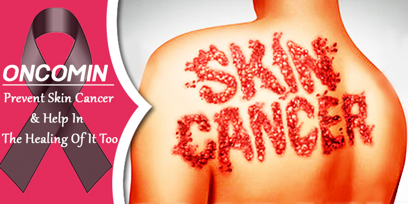 treat skin cancer with oncomin
